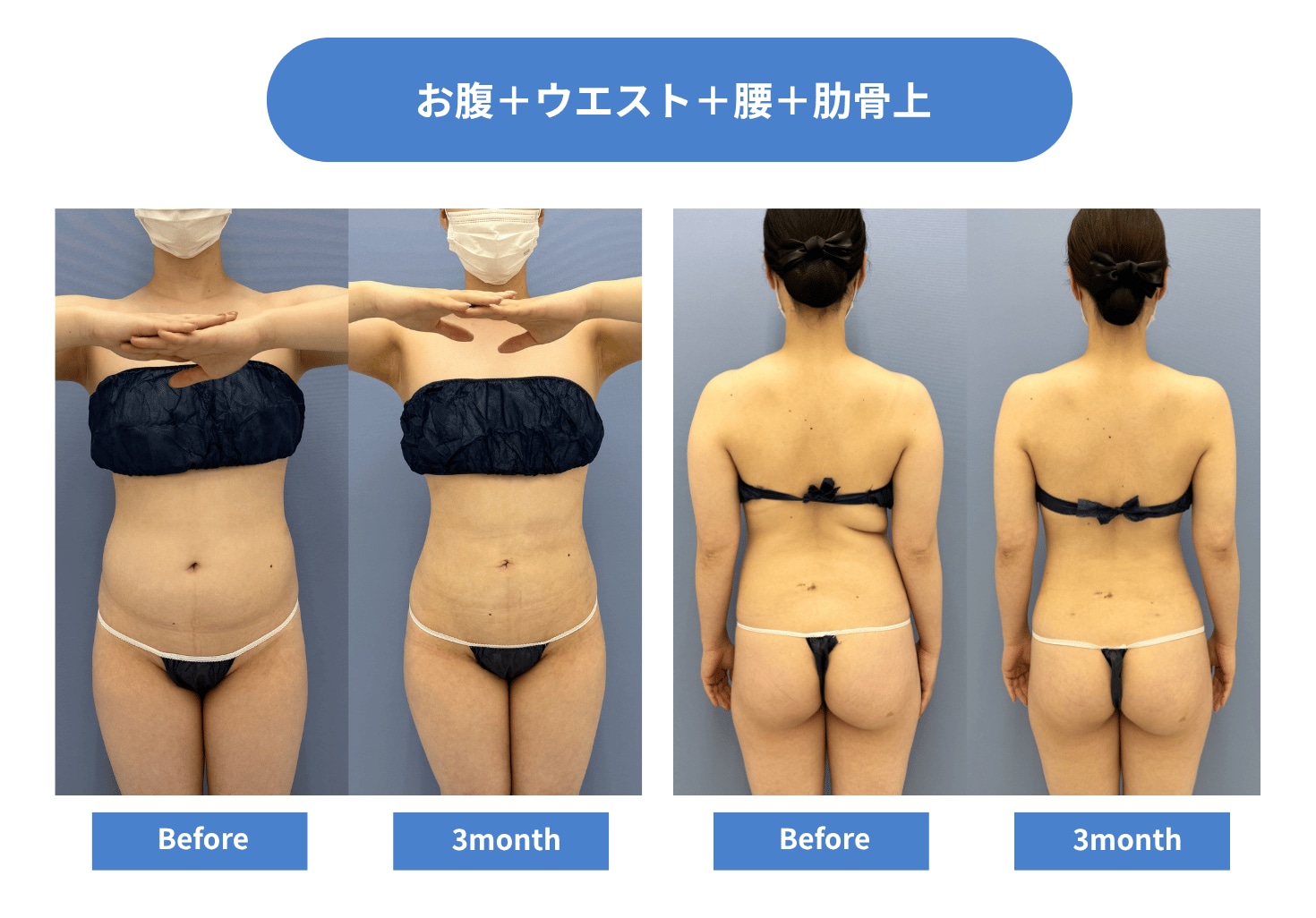 CASE 03
