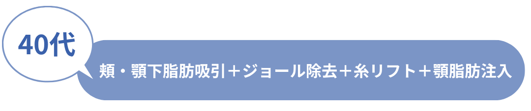 ビフォーアフター