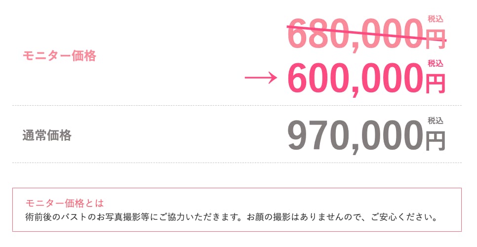 脂肪注入 キャンペーン価格
