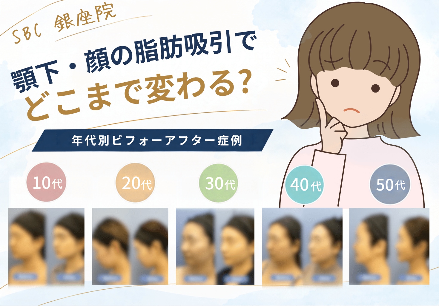 顎下・顔の脂肪吸引でどのぐらい変わる?|年齢別ビフォーアフター症例