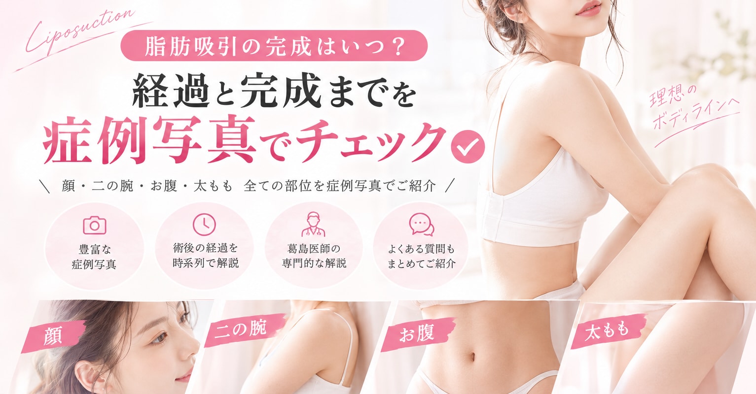 脂肪吸引の完成はいつ？経過と完成までを症例写真でチェック