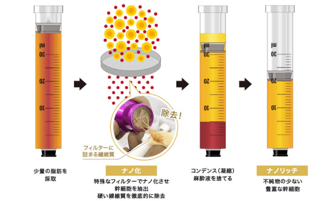 赤＆青クマの治療法