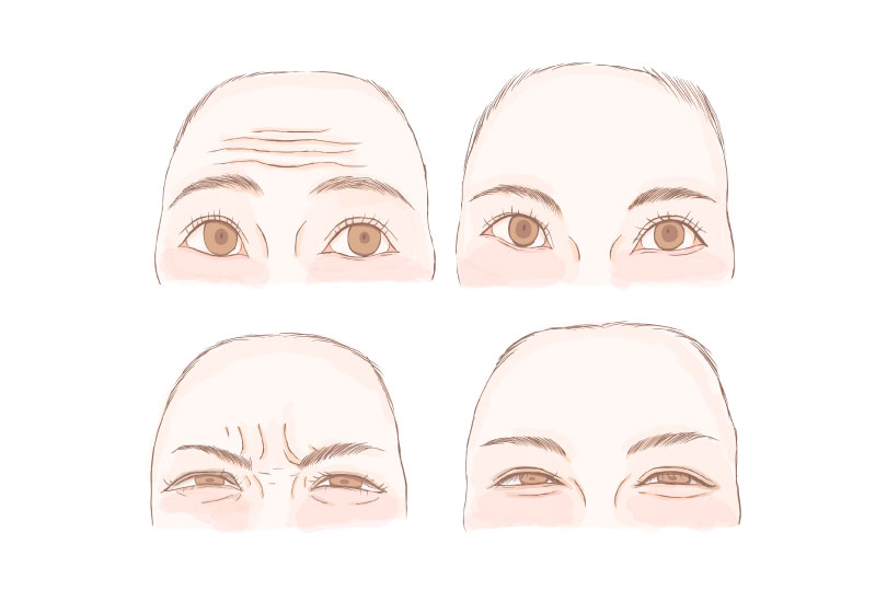 シワってそもそも何故できる?
