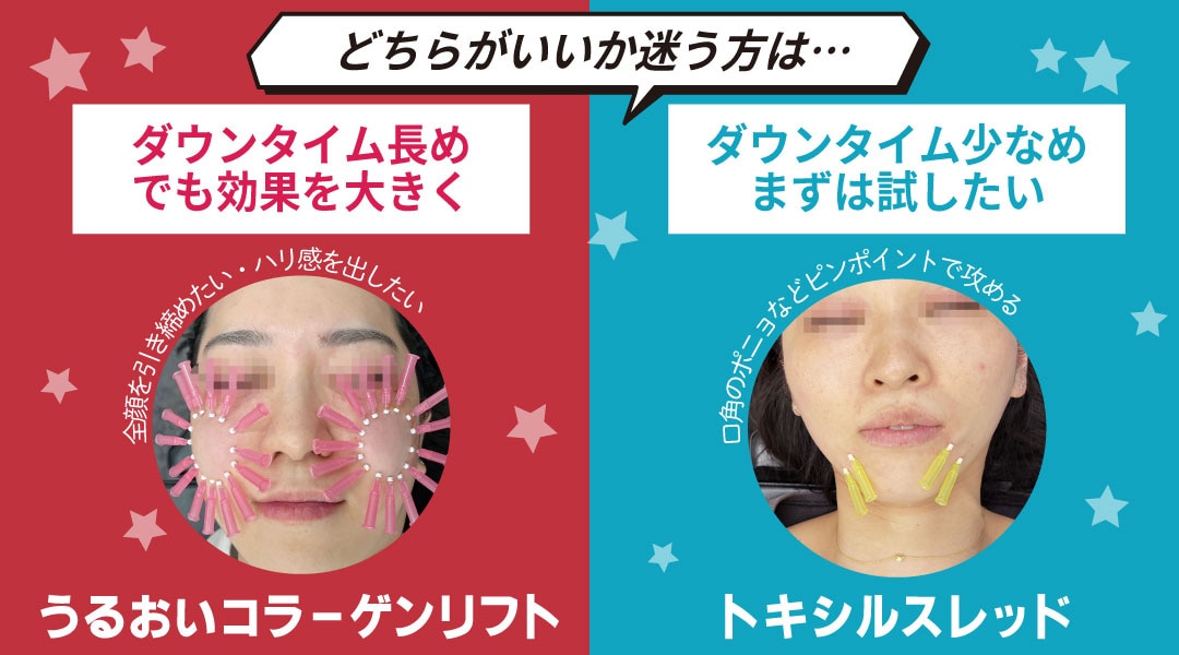 選び方のコツはある?