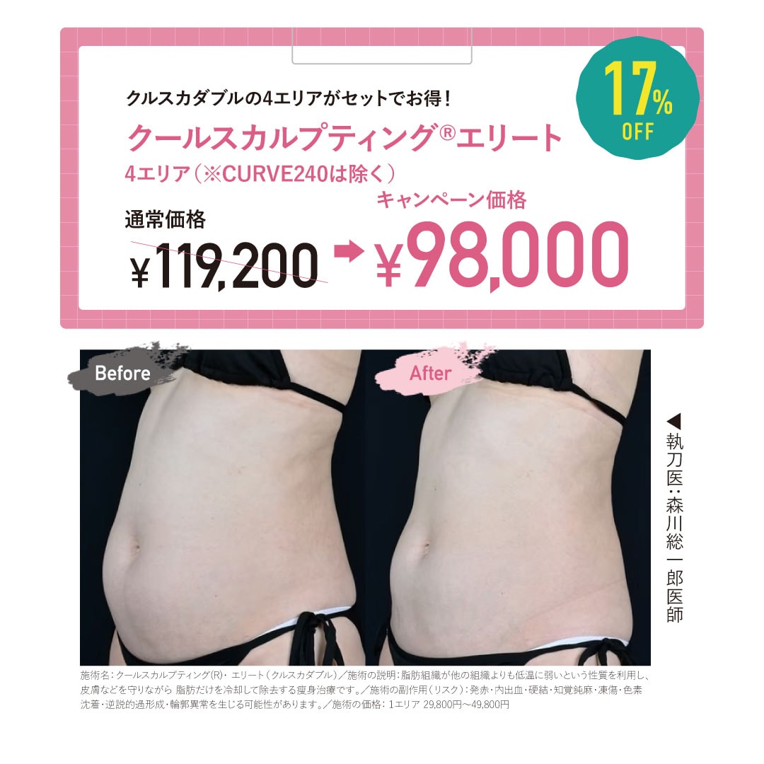 クルスカダブル