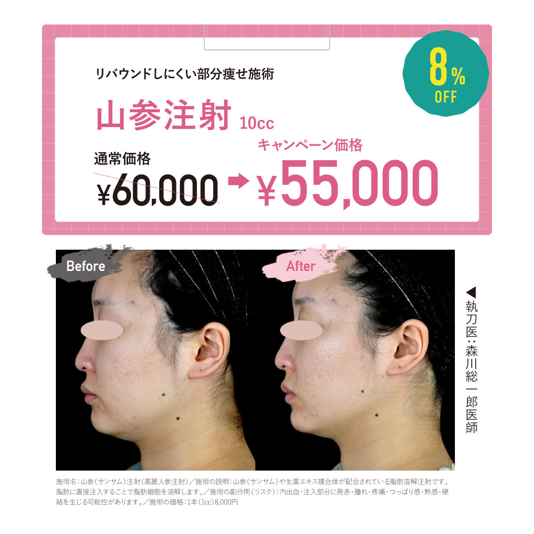 山参(サンサム)注射