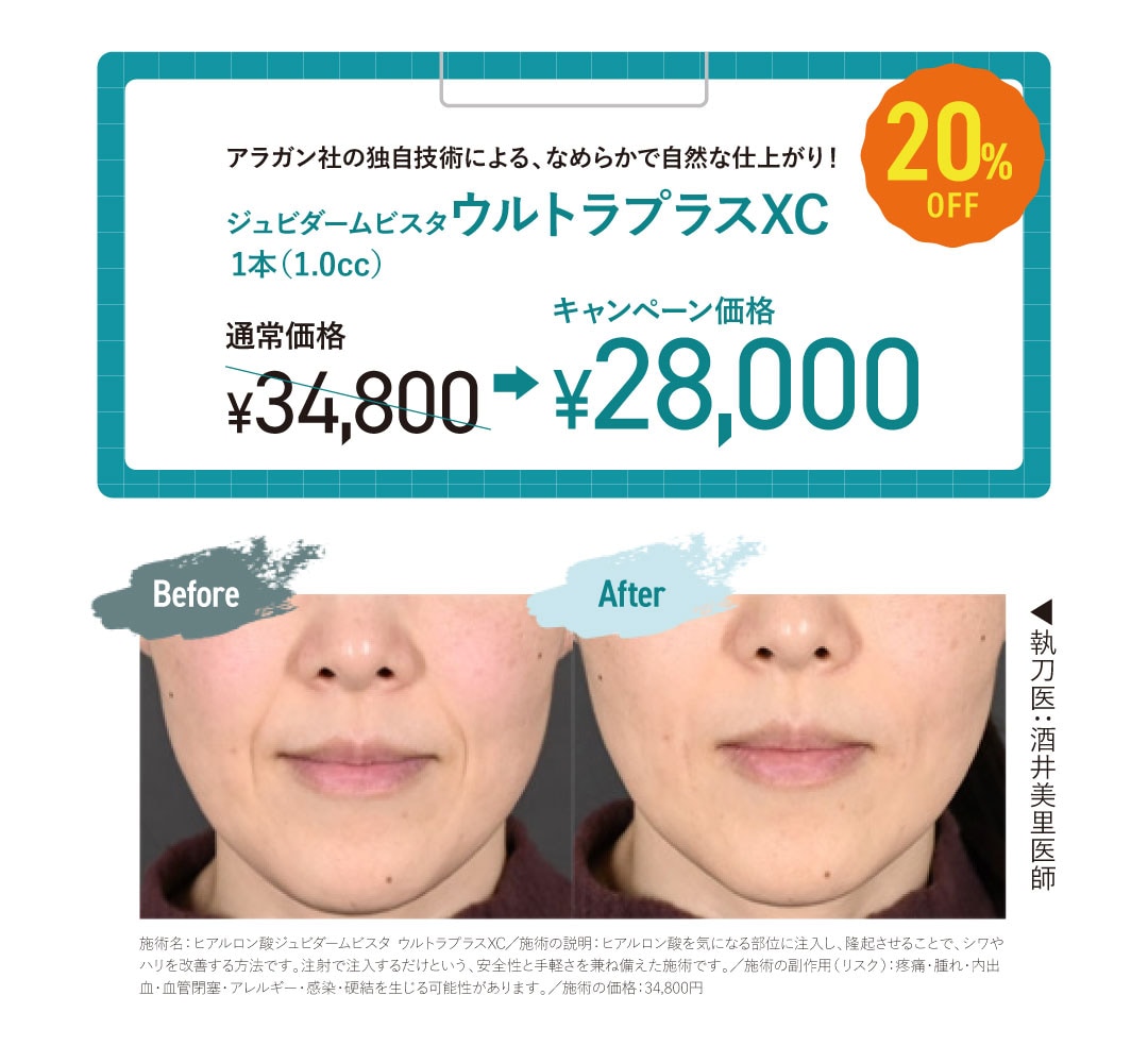 ヒアルロン酸