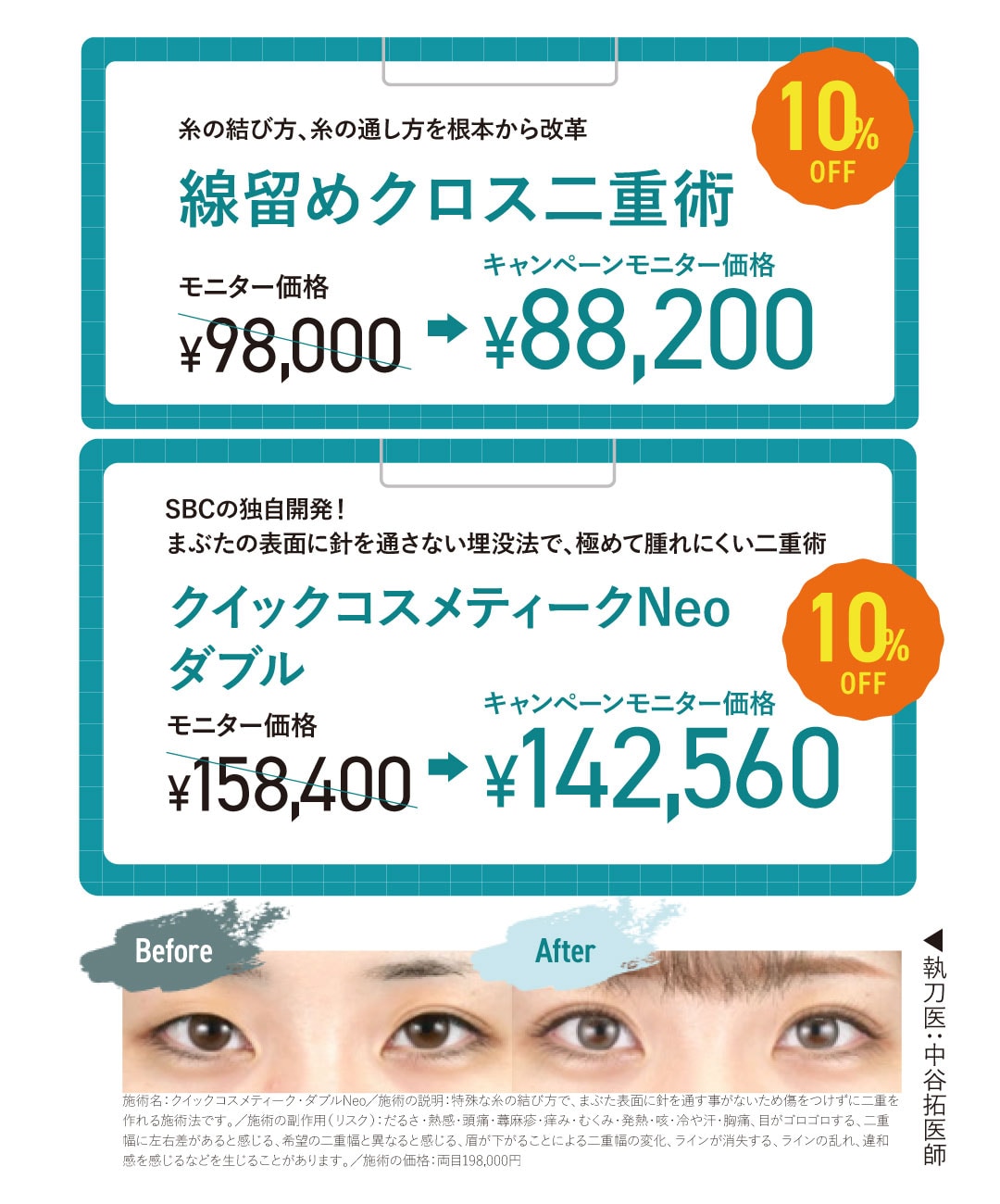 二重埋没法