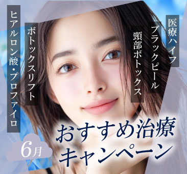キャンペーン解説