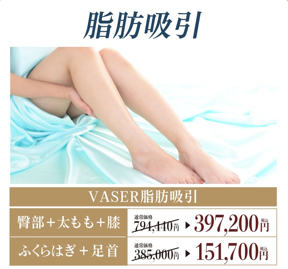 VASER脂肪吸引