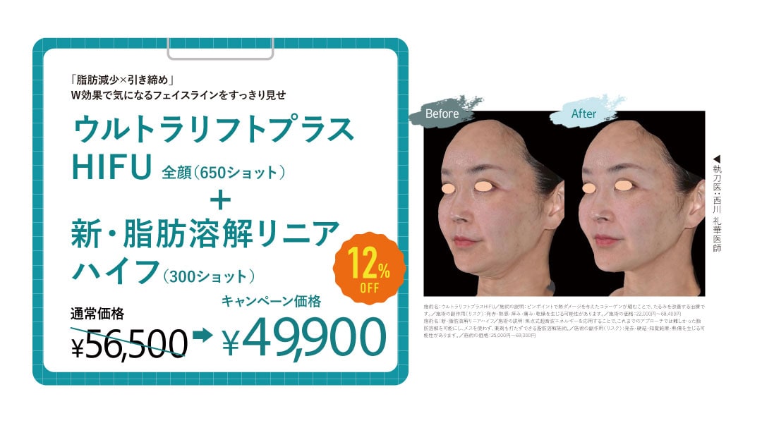 『ウルトラリフトプラスHIFU』+『新・脂肪溶解リニアハイフ』セット割引