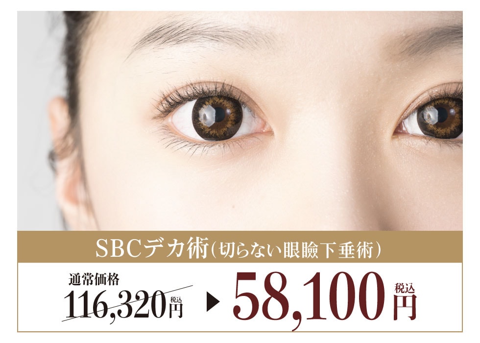 SBCデカ目術