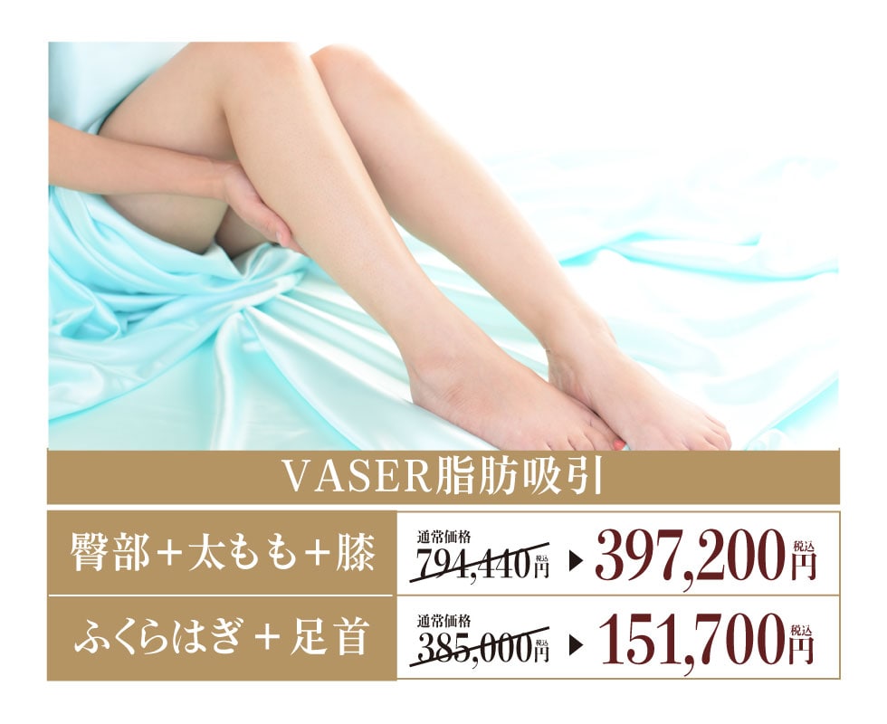 VASER脂肪吸引