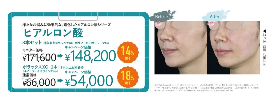 ヒアルロン酸