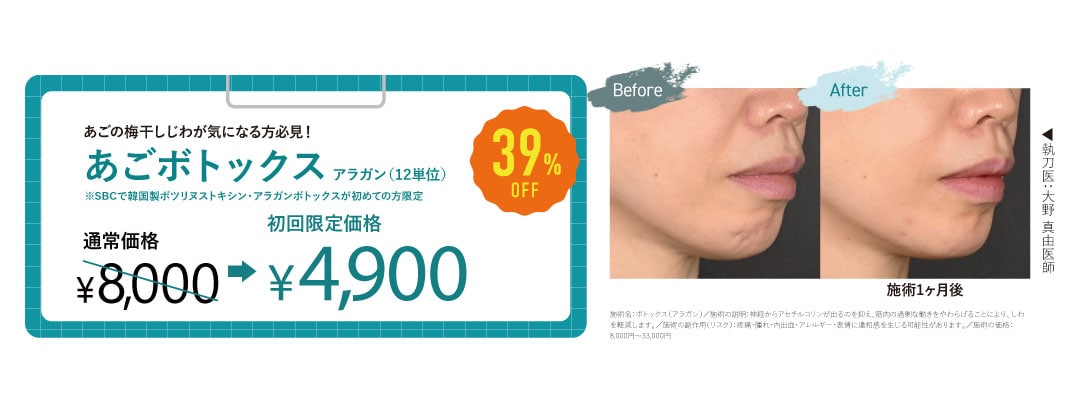 アゴボトックス（12単位）