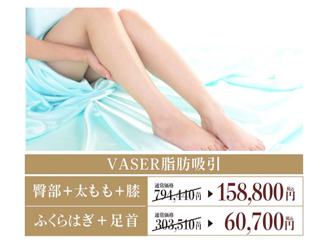 VASER脂肪吸引