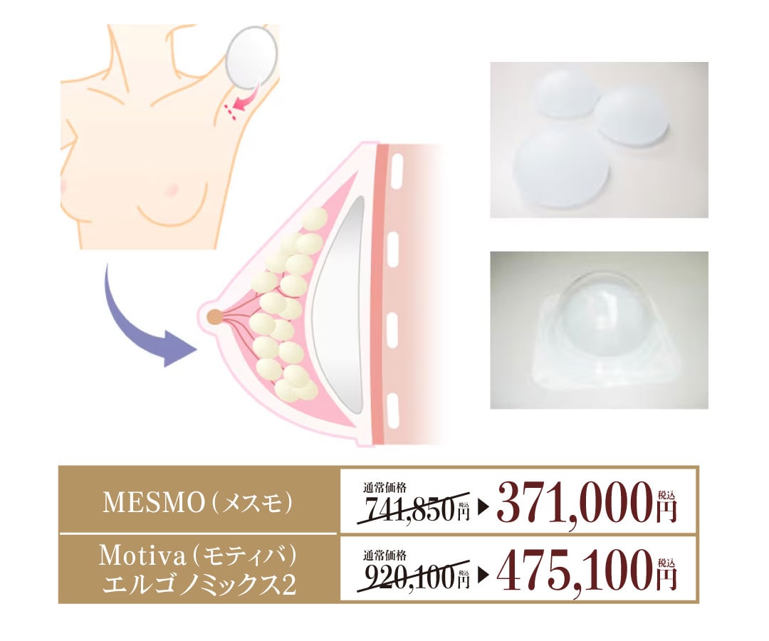 シリコンバッグ豊胸