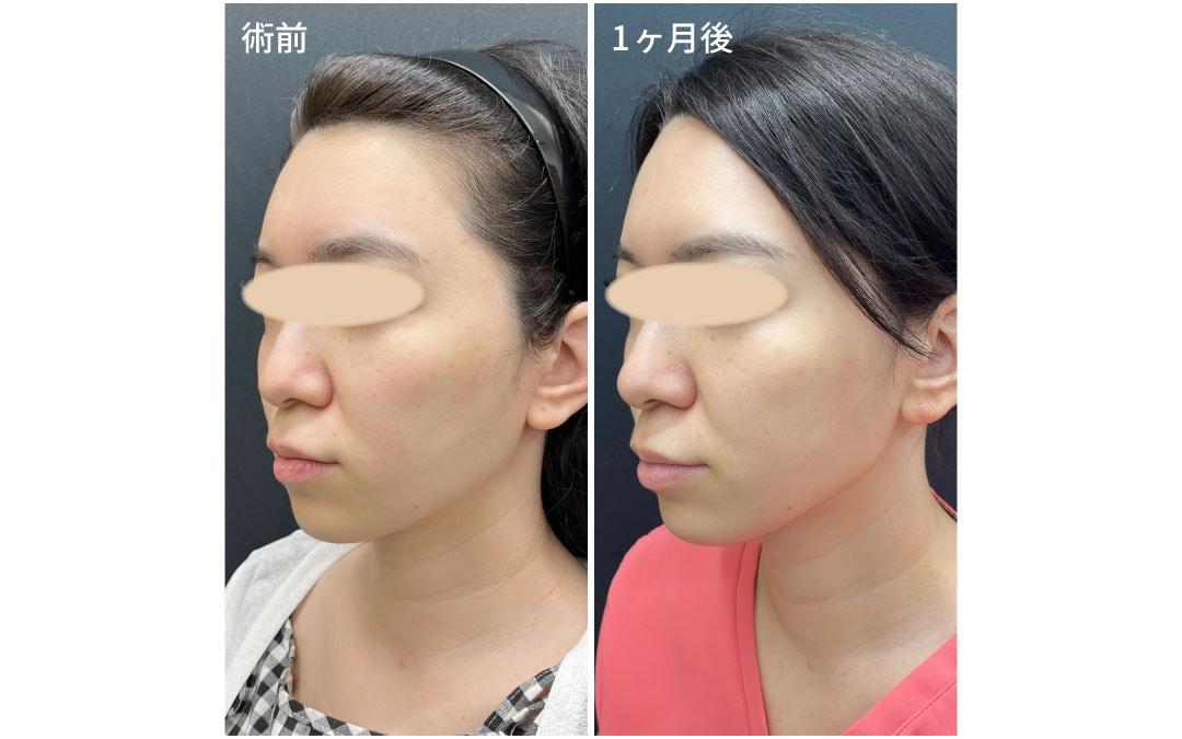 1ヶ月後どうなった？