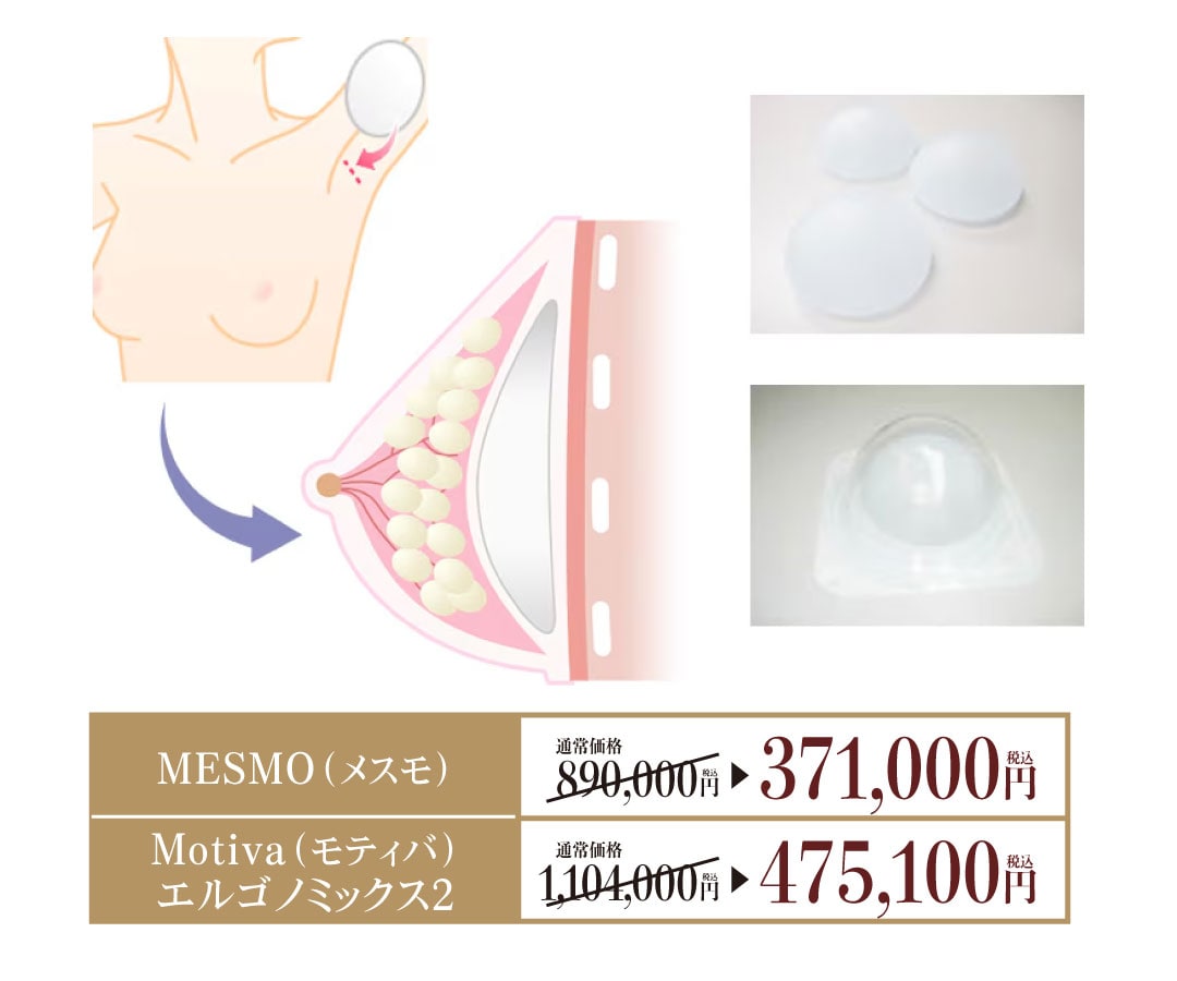 SBCプレミアムソフトプロテーゼ