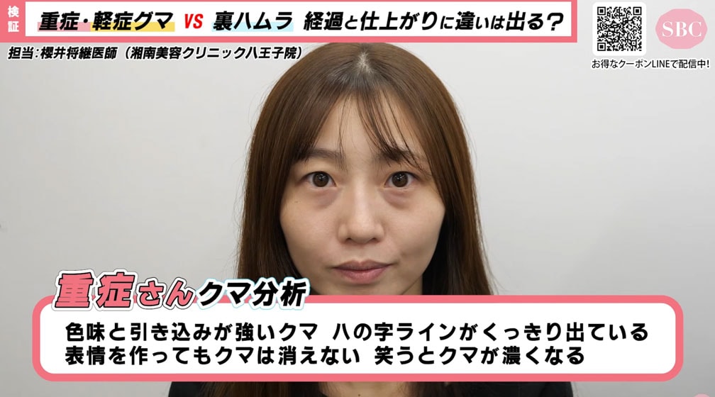 重症さん・20代女性