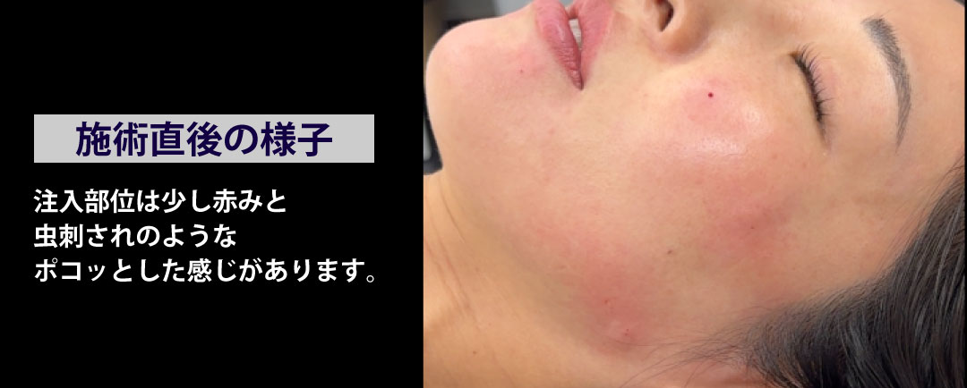 ダウンタイム