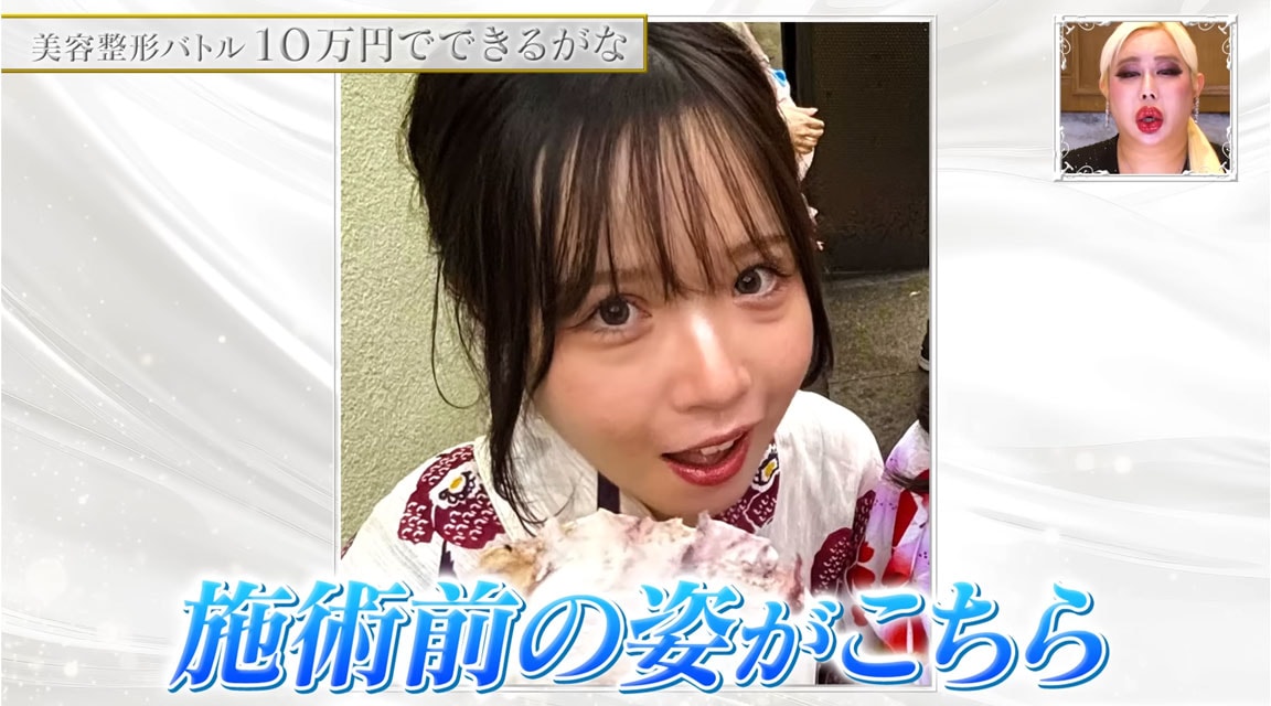 涙袋が2段ある!?
