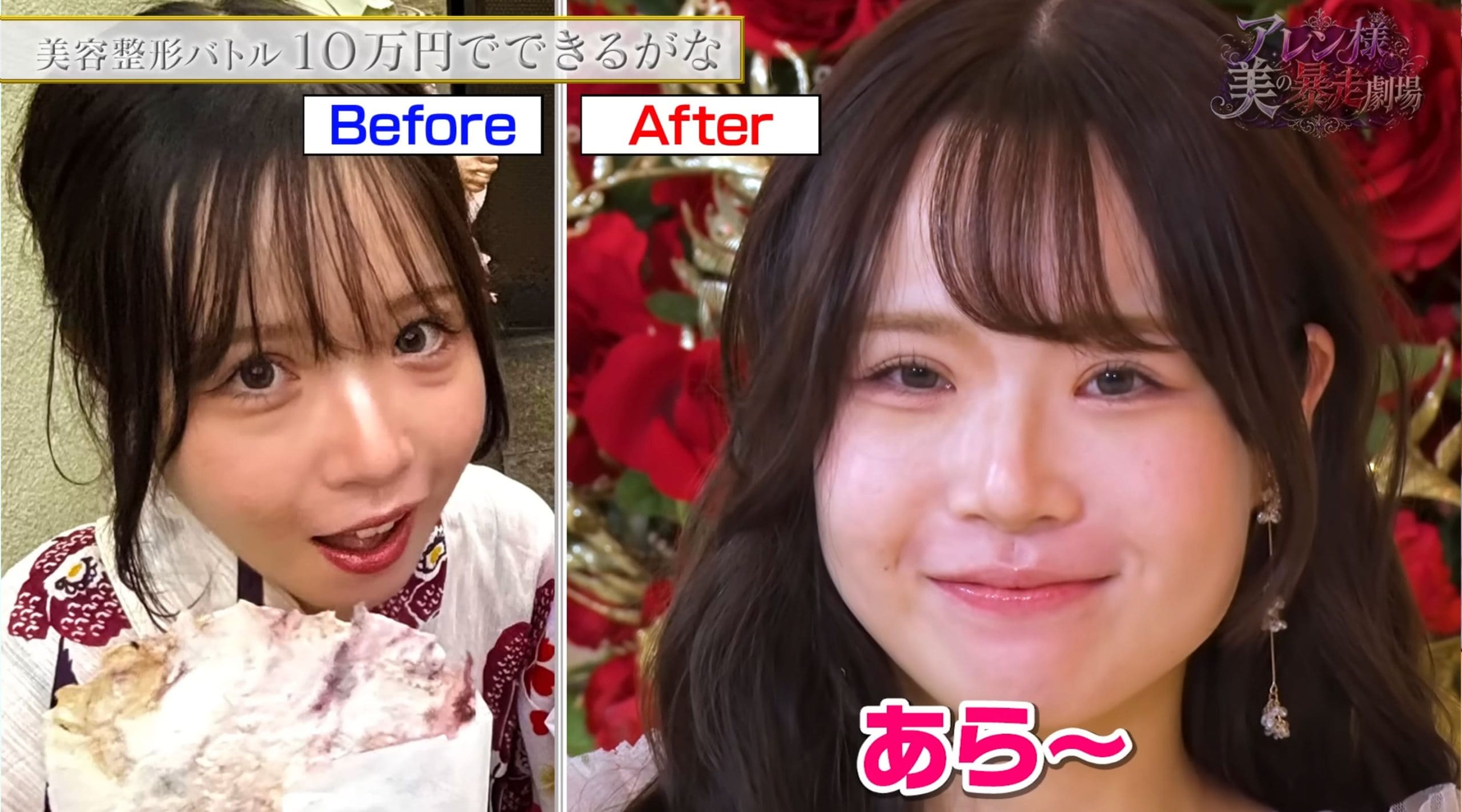 クマ取りの手術を決意！その結果は？