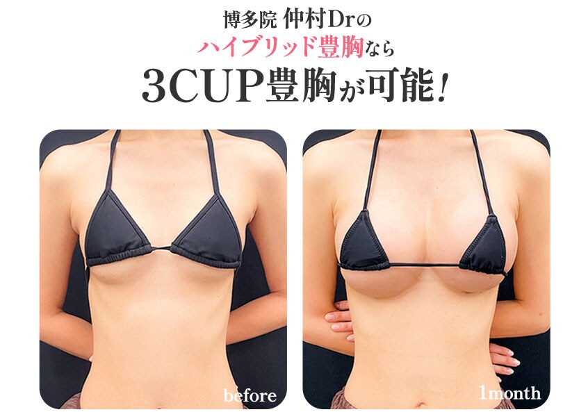 シリコンなのに自然なハイブリッド豊胸が得意!<br />