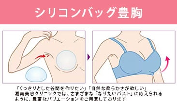 今よりも2カップ以上大きなバストになりたい方は<br />