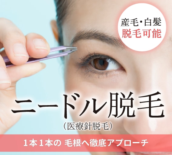 【SBC博多院】ついにニードル脱毛開始！気になる施術の流れを徹底解説