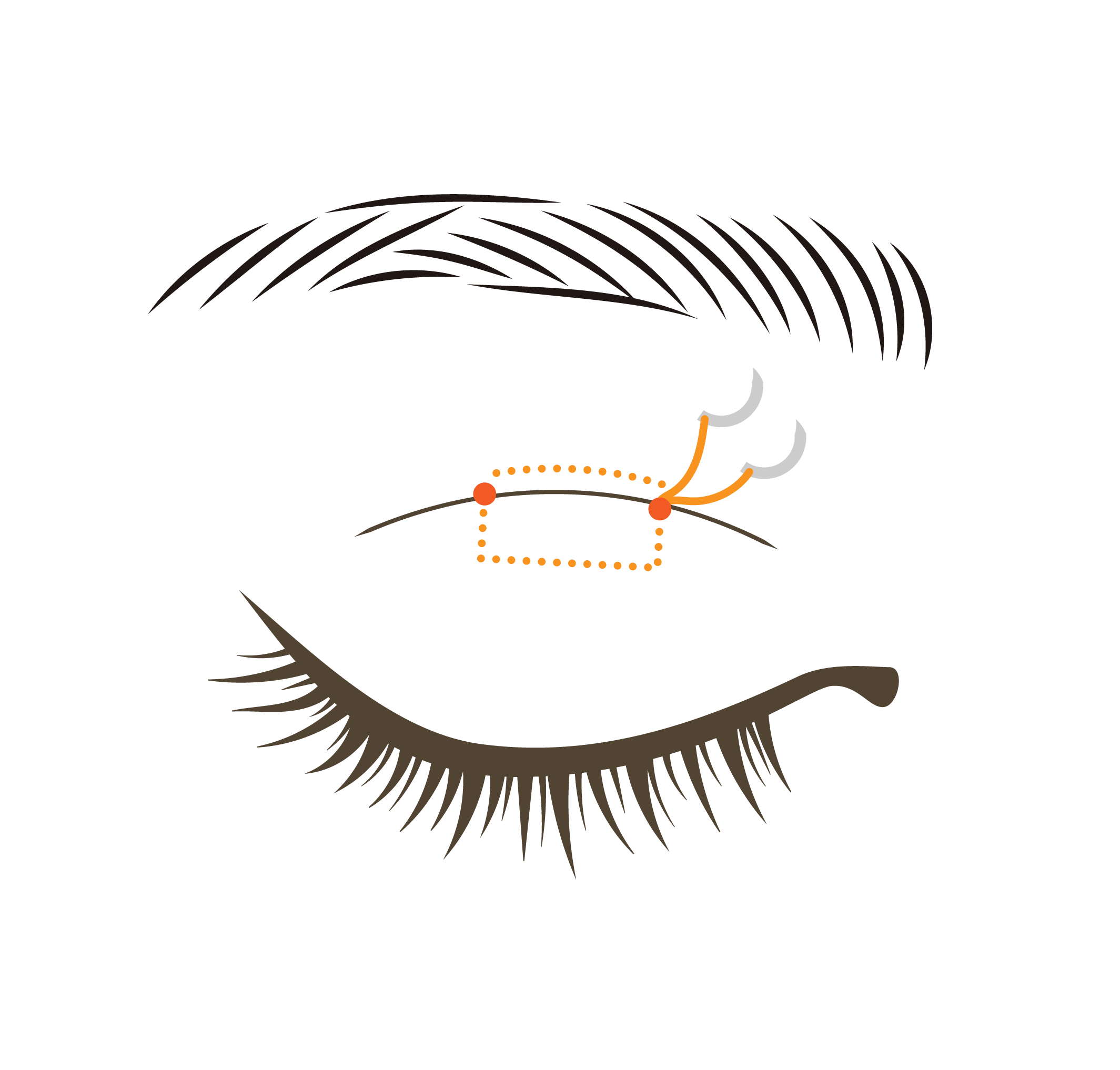埋没法 イラスト
