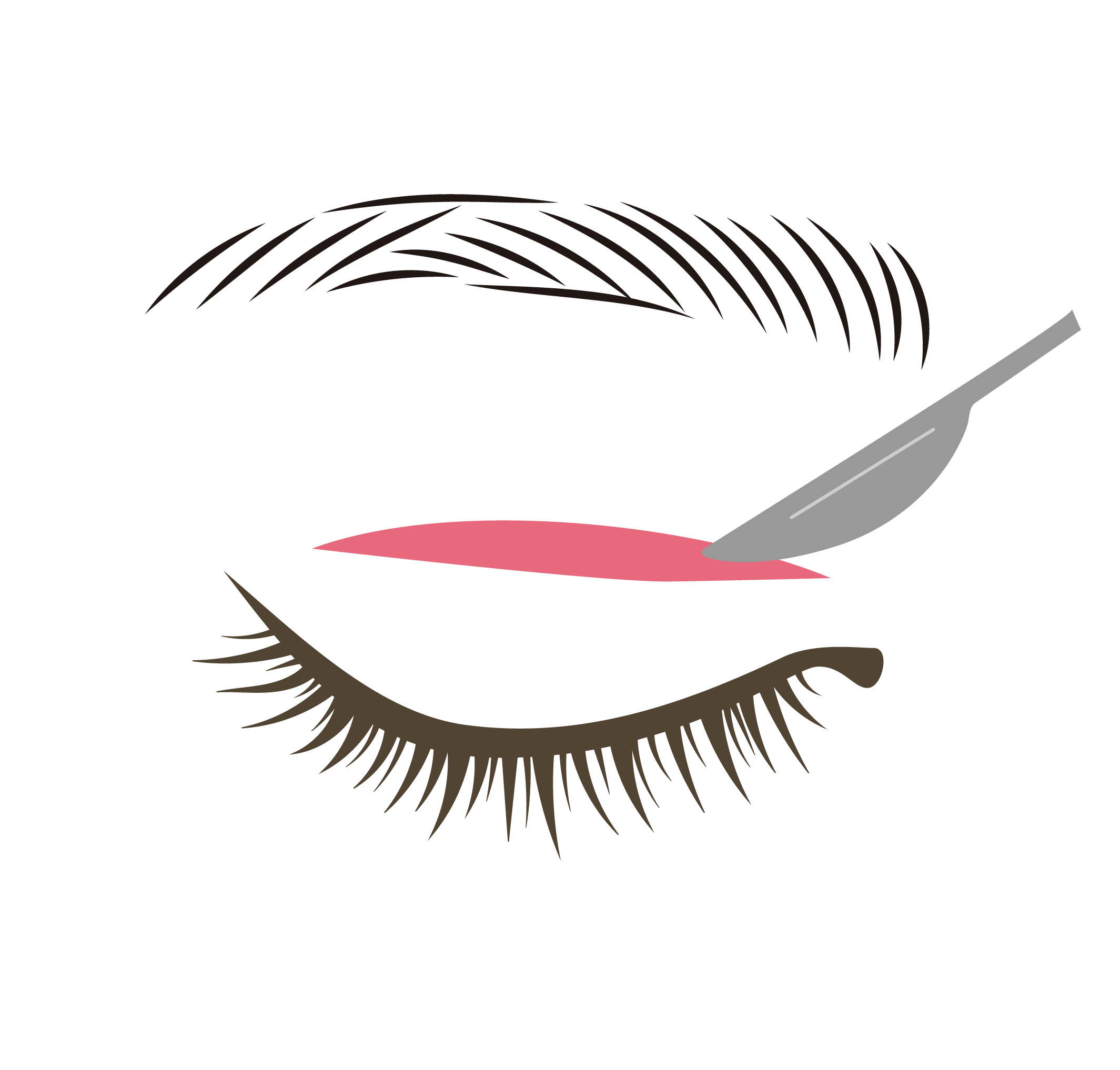 切開法 イラスト