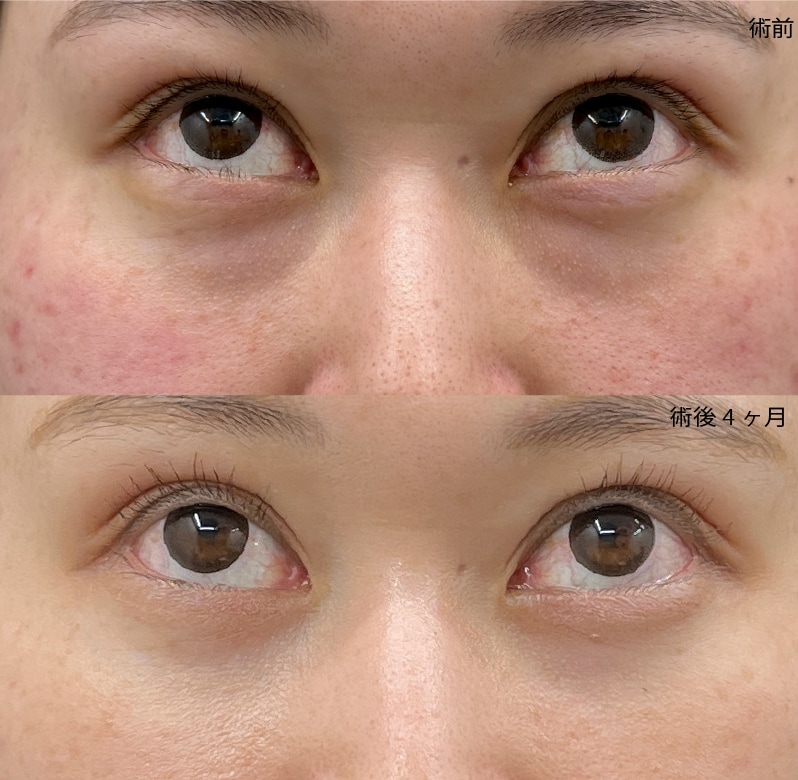 28歳女性