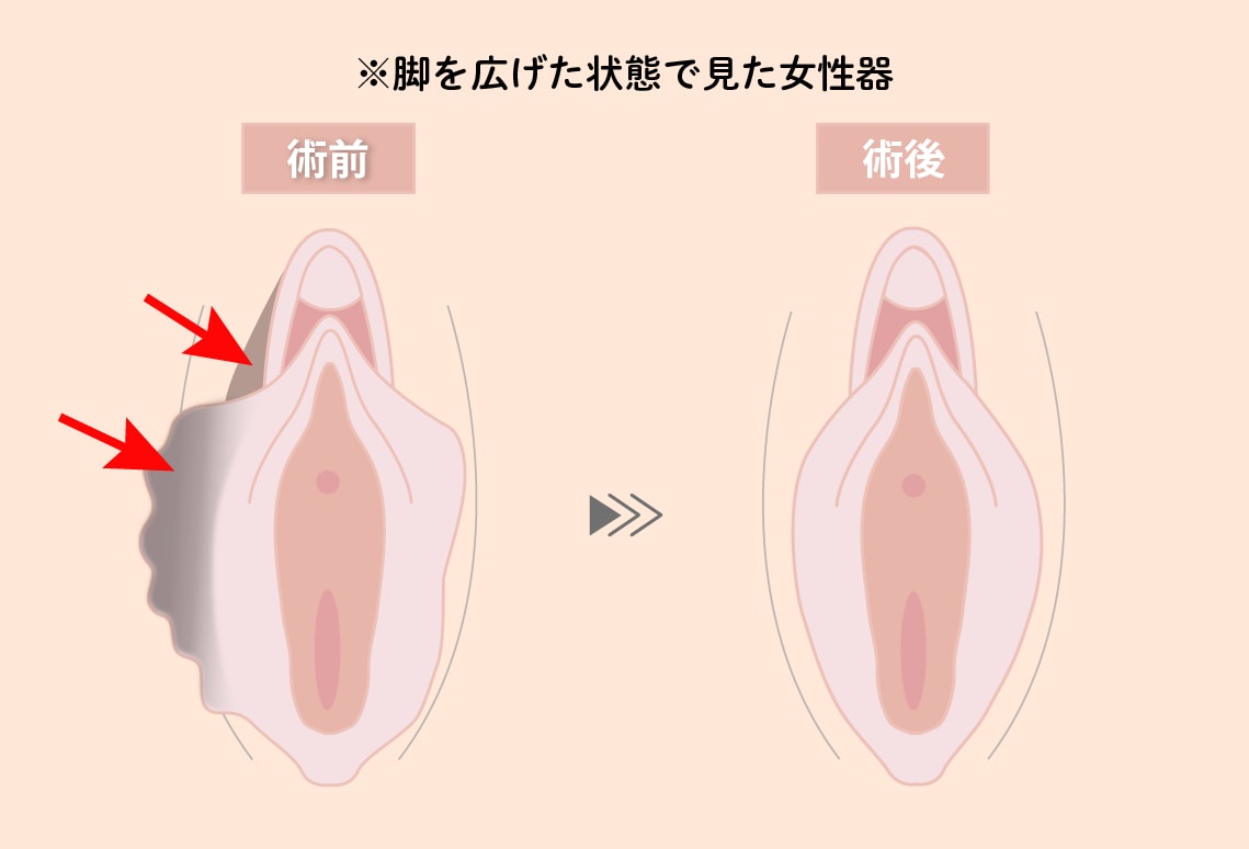 大きさがある方<br />