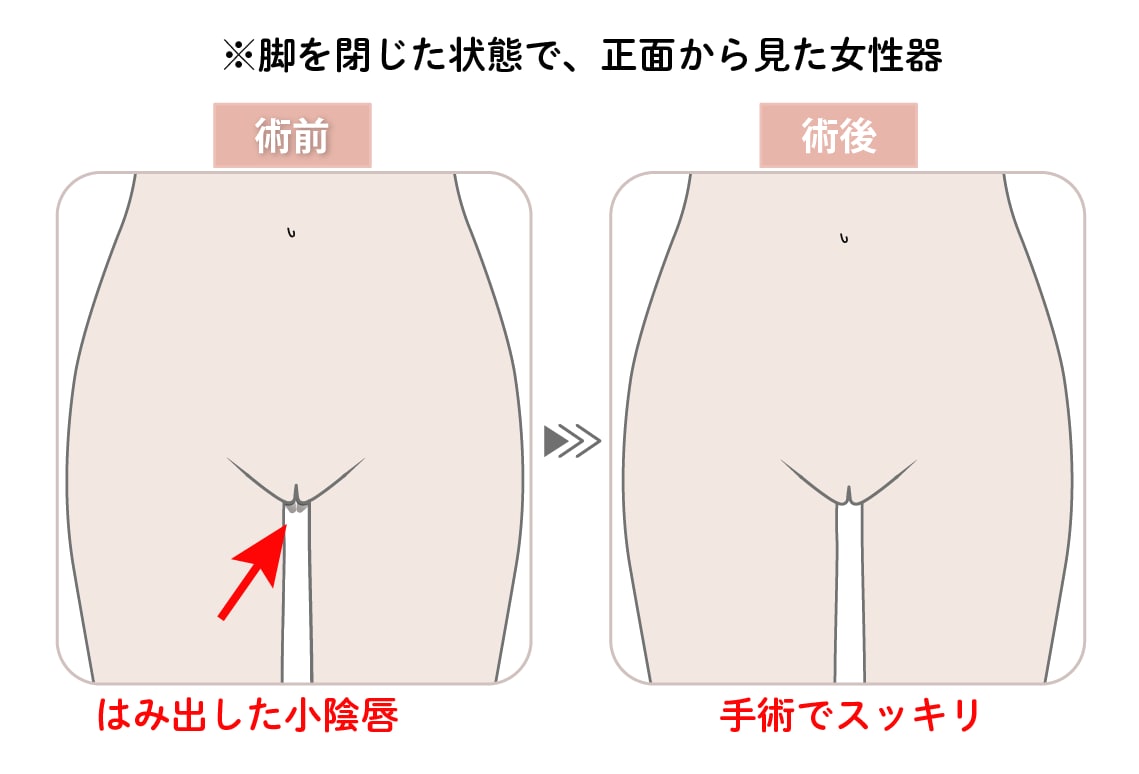 デザインへのこだわり