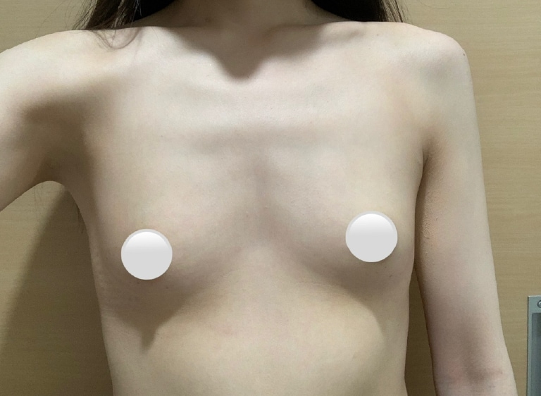 手術前