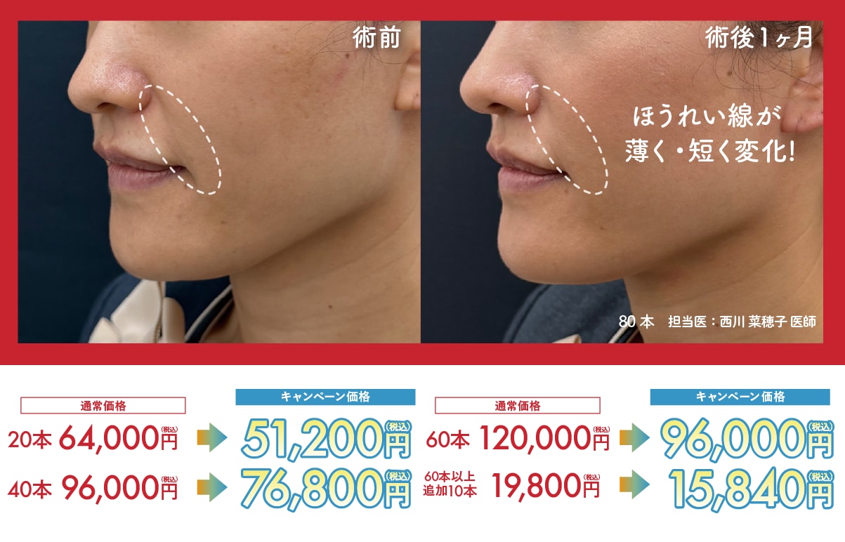 うるおいコラーゲンリフト