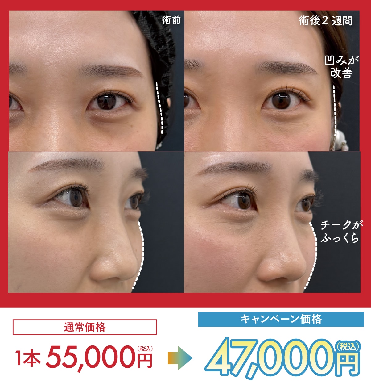 ジャルプロスーパーハイドロ