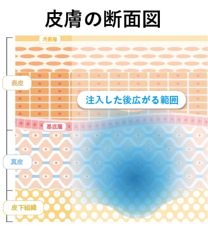 プロファイロの拡散性