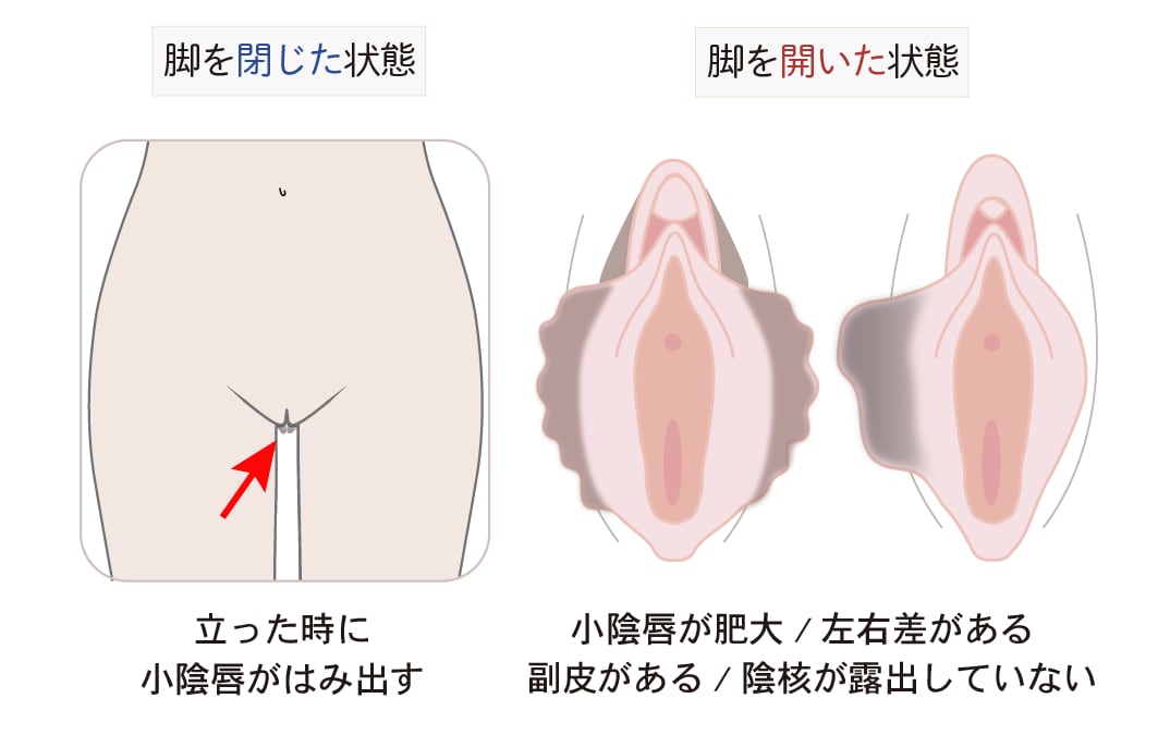 こんな状態だったら・・・