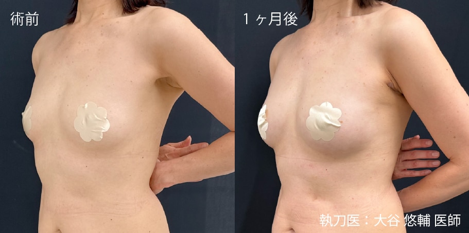 症例写真2