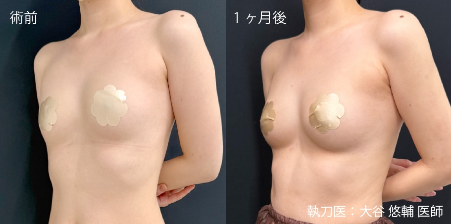 症例写真1