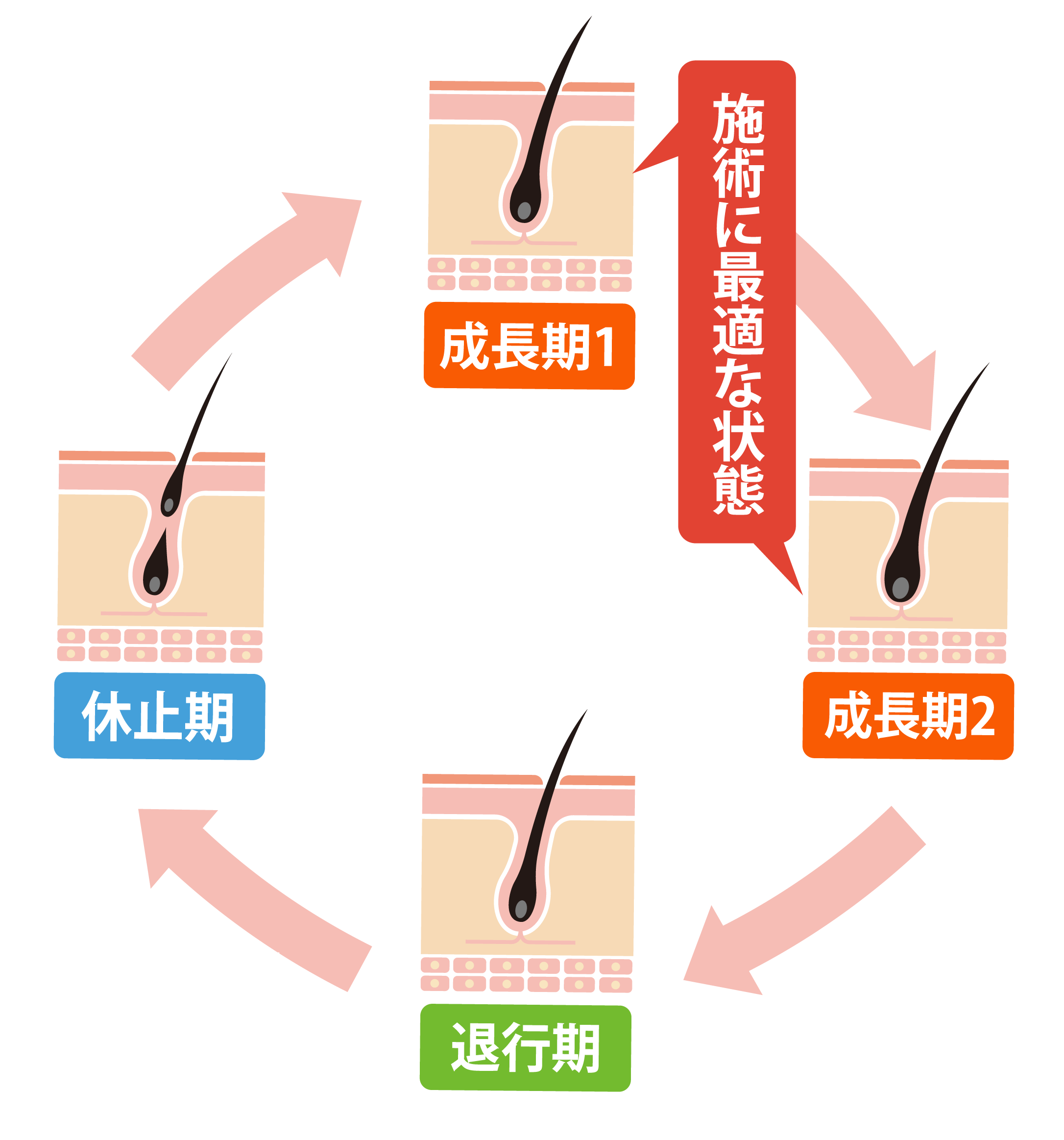 毛周期(ヘアサイクル)の画像