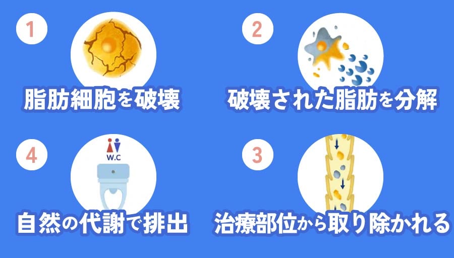クルスカは脂肪を「小さくする」ではなく「破壊する」