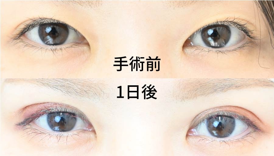 スタッフのBefore・After