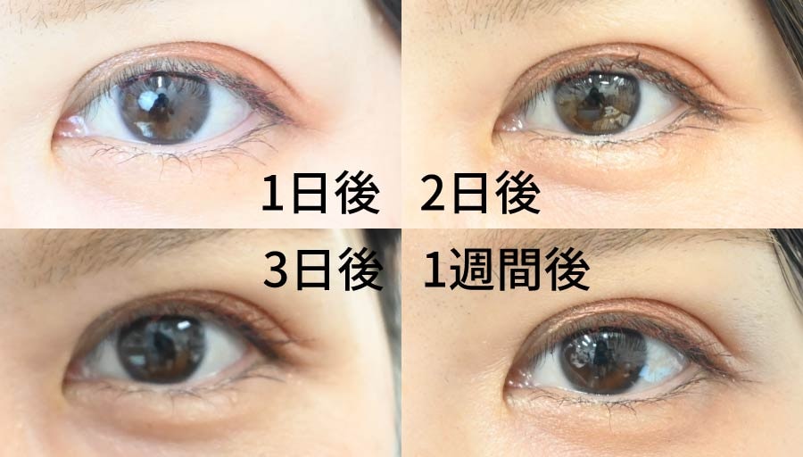 気になるダウンタイムは?