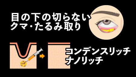 今回の治療内容は・・・?