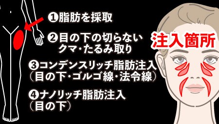 治療メニューの詳細