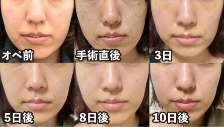 浜松院スタッフにダウンタイムを毎日撮影してもらいました!