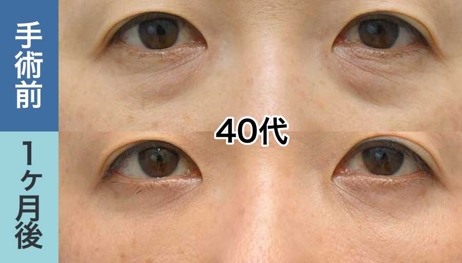 40代女性の症例